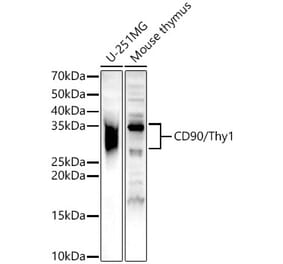 Western Blot - Anti-CD90 / Thy1 Antibody (A13891) - Antibodies.com