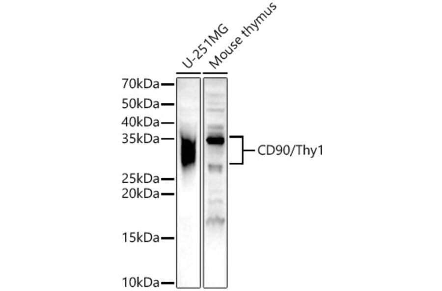 Western Blot - Anti-CD90/Thy1 Antibody (A13891) - Antibodies.com