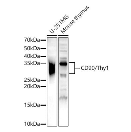 Western Blot - Anti-CD90 / Thy1 Antibody (A13891) - Antibodies.com