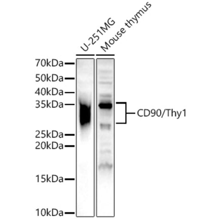 Western Blot - Anti-CD90/Thy1 Antibody (A13891) - Antibodies.com