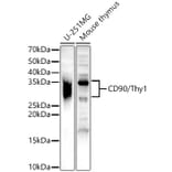 Western Blot - Anti-CD90/Thy1 Antibody (A13891) - Antibodies.com
