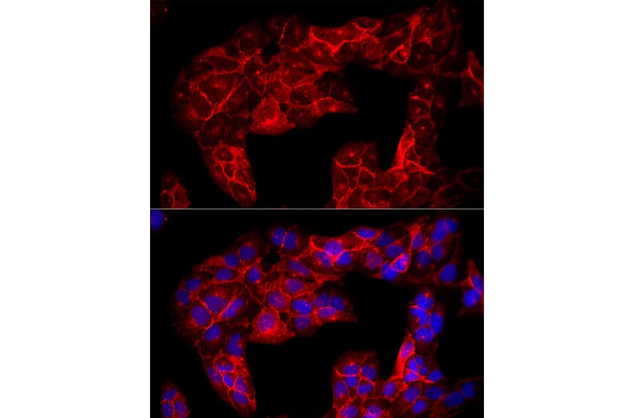 Immunofluorescence - Anti-CD90/Thy1 Antibody (A13891) - Antibodies.com