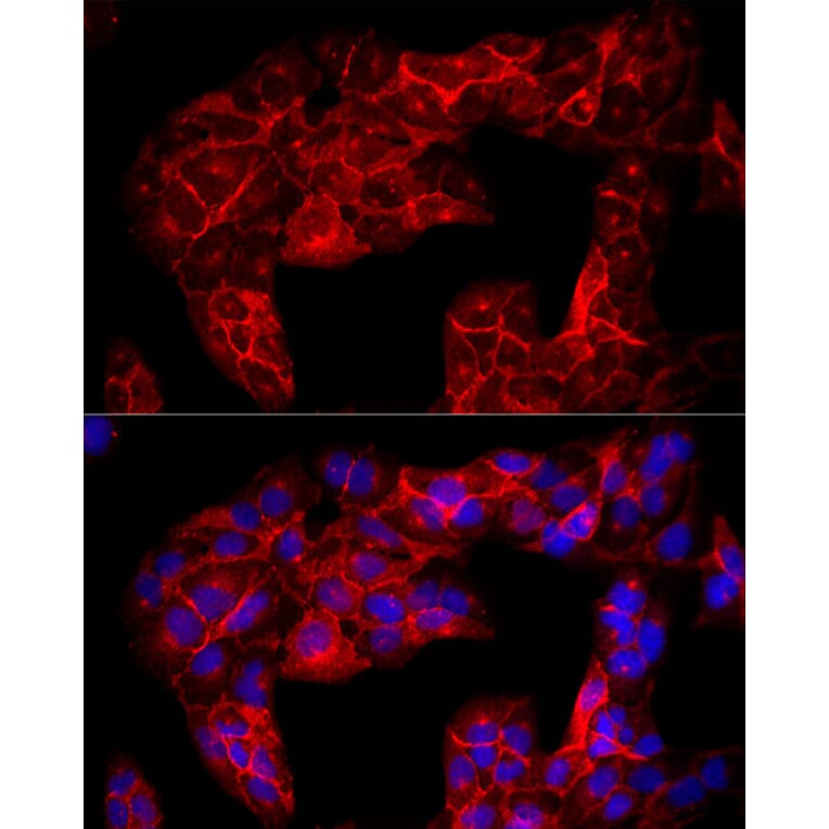 Immunofluorescence - Anti-CD90/Thy1 Antibody (A13891) - Antibodies.com