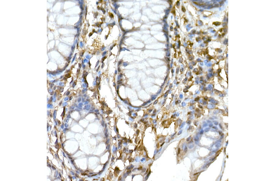 Immunohistochemistry - Anti-TNFAIP3 Antibody (A13892) - Antibodies.com