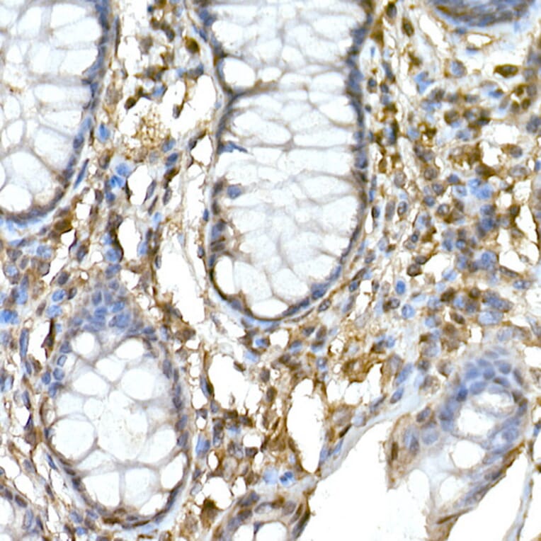 Immunohistochemistry - Anti-TNFAIP3 Antibody (A13892) - Antibodies.com