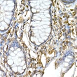 Immunohistochemistry - Anti-TNFAIP3 Antibody (A13892) - Antibodies.com