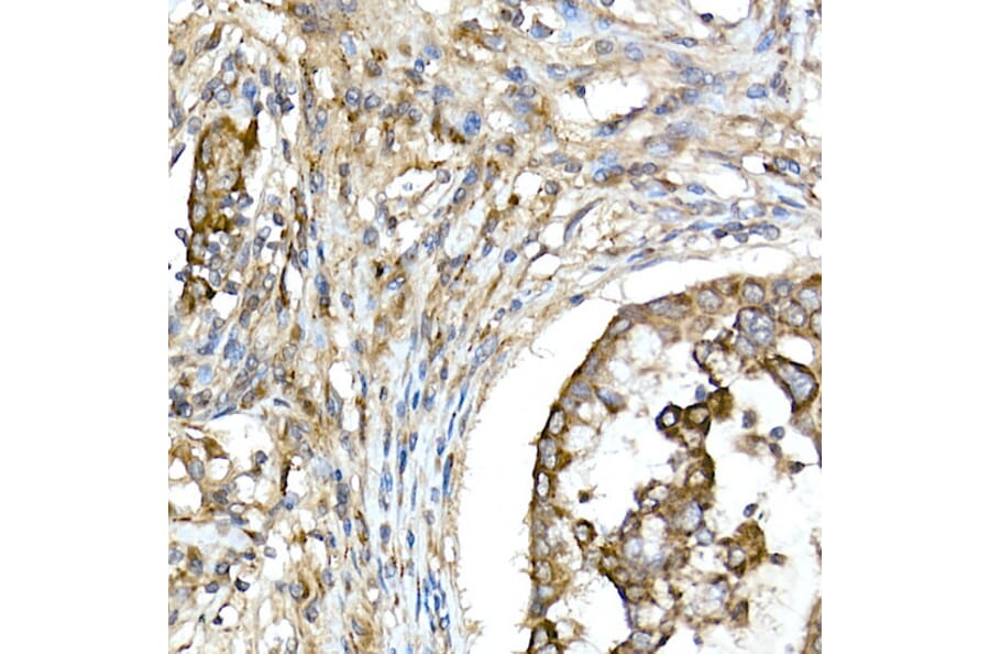 Immunohistochemistry - Anti-TNFAIP3 Antibody (A13892) - Antibodies.com