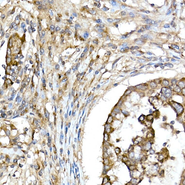 Immunohistochemistry - Anti-TNFAIP3 Antibody (A13892) - Antibodies.com