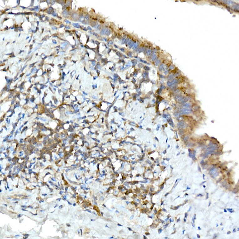 Immunohistochemistry - Anti-TNFAIP3 Antibody (A13892) - Antibodies.com