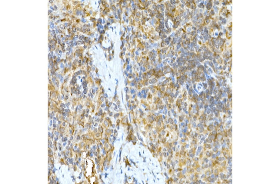 Immunohistochemistry - Anti-TNFAIP3 Antibody (A13892) - Antibodies.com