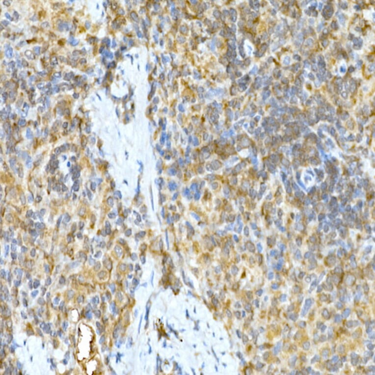 Immunohistochemistry - Anti-TNFAIP3 Antibody (A13892) - Antibodies.com