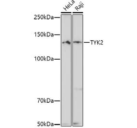 Western Blot - Anti-TYK2 Antibody (A13893) - Antibodies.com