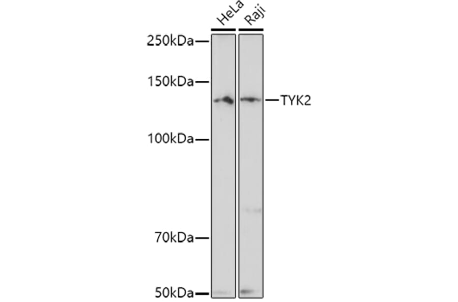 Western Blot - Anti-TYK2 Antibody (A13893) - Antibodies.com
