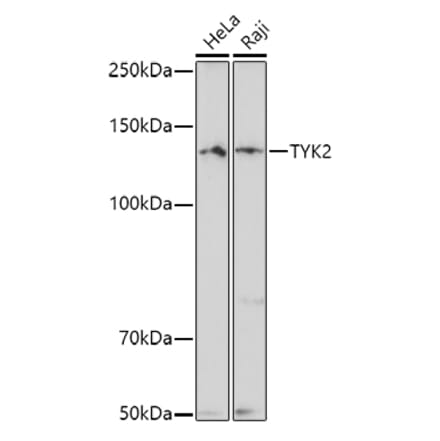 Western Blot - Anti-TYK2 Antibody (A13893) - Antibodies.com