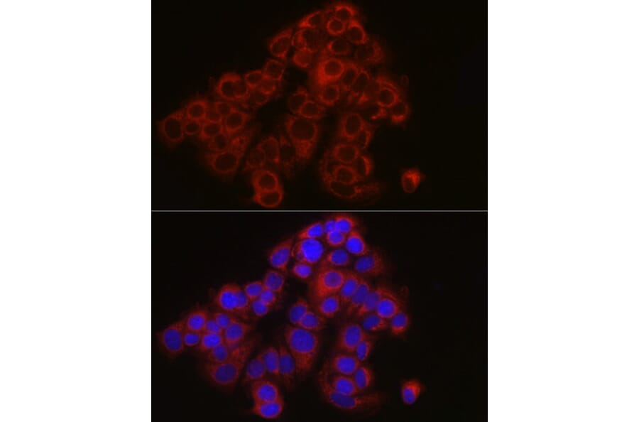 Immunofluorescence - Anti-TYK2 Antibody (A13893) - Antibodies.com