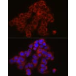 Immunofluorescence - Anti-TYK2 Antibody (A13893) - Antibodies.com