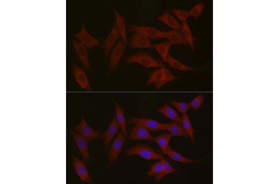 Immunofluorescence - Anti-TYK2 Antibody (A13893) - Antibodies.com
