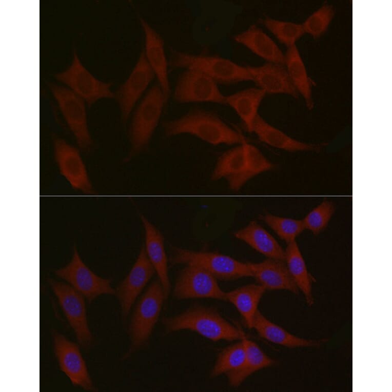 Immunofluorescence - Anti-TYK2 Antibody (A13893) - Antibodies.com