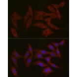 Immunofluorescence - Anti-TYK2 Antibody (A13893) - Antibodies.com