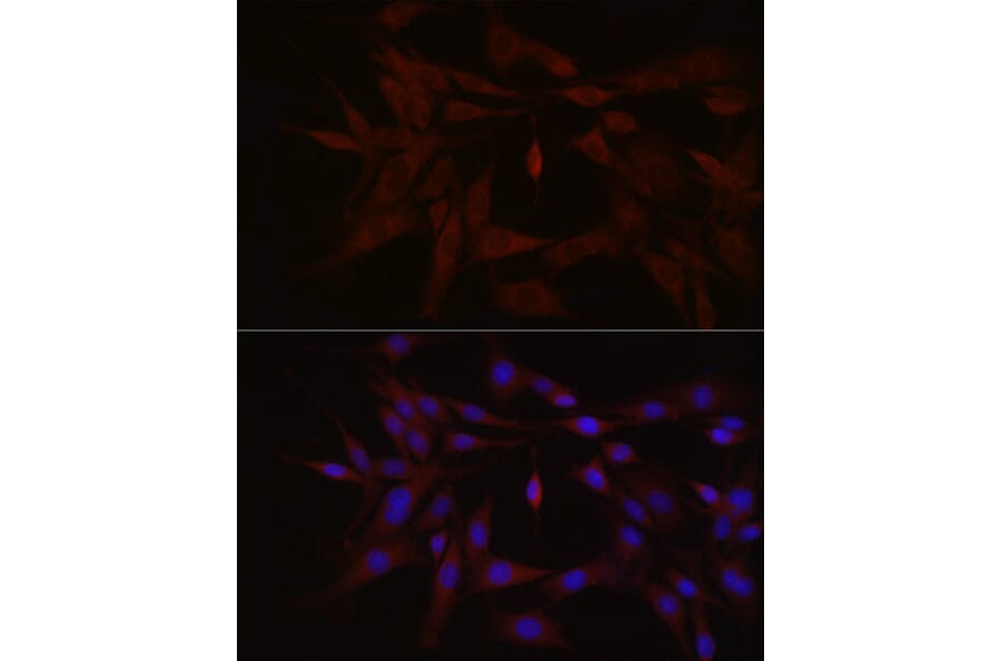 Immunofluorescence - Anti-TYK2 Antibody (A13893) - Antibodies.com