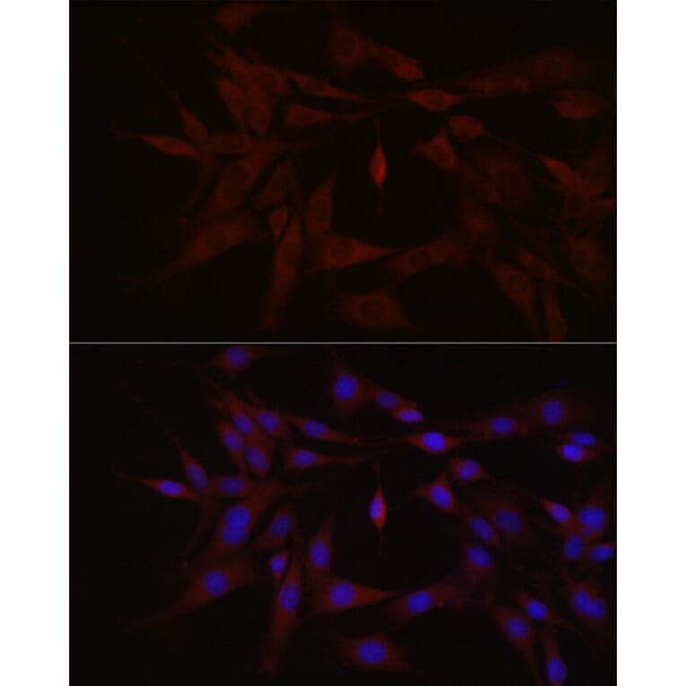 Immunofluorescence - Anti-TYK2 Antibody (A13893) - Antibodies.com