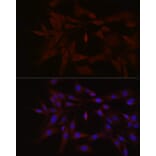 Immunofluorescence - Anti-TYK2 Antibody (A13893) - Antibodies.com