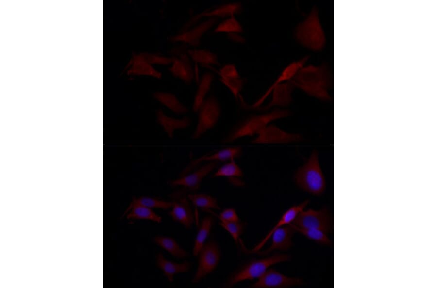 Immunofluorescence - Anti-TYK2 Antibody (A13893) - Antibodies.com