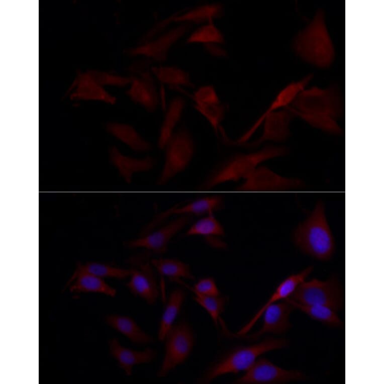 Immunofluorescence - Anti-TYK2 Antibody (A13893) - Antibodies.com