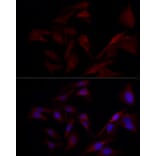 Immunofluorescence - Anti-TYK2 Antibody (A13893) - Antibodies.com