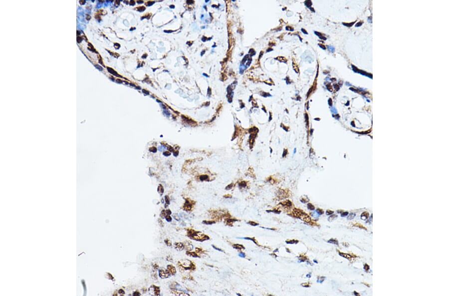 Immunohistochemistry - Anti-Ubiquitin Antibody (A13894) - Antibodies.com