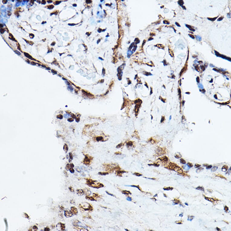 Immunohistochemistry - Anti-Ubiquitin Antibody (A13894) - Antibodies.com