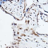 Immunohistochemistry - Anti-Ubiquitin Antibody (A13894) - Antibodies.com