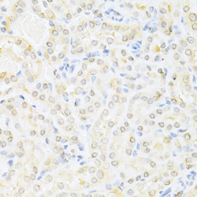 Immunohistochemistry - Anti-SUMO1 Antibody (A2130) - Antibodies.com