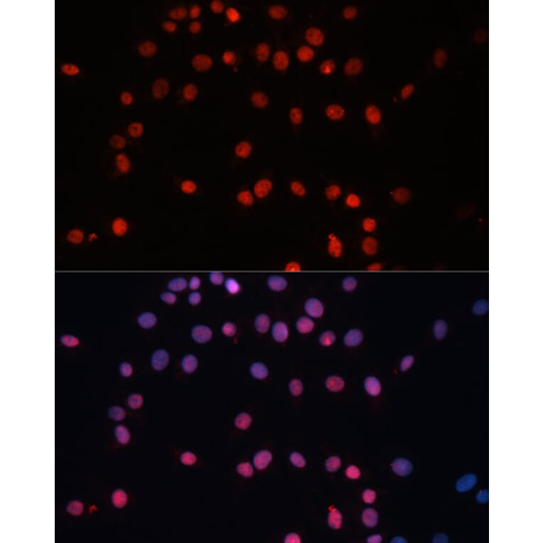 Immunofluorescence - Anti-SUMO1 Antibody (A2130) - Antibodies.com