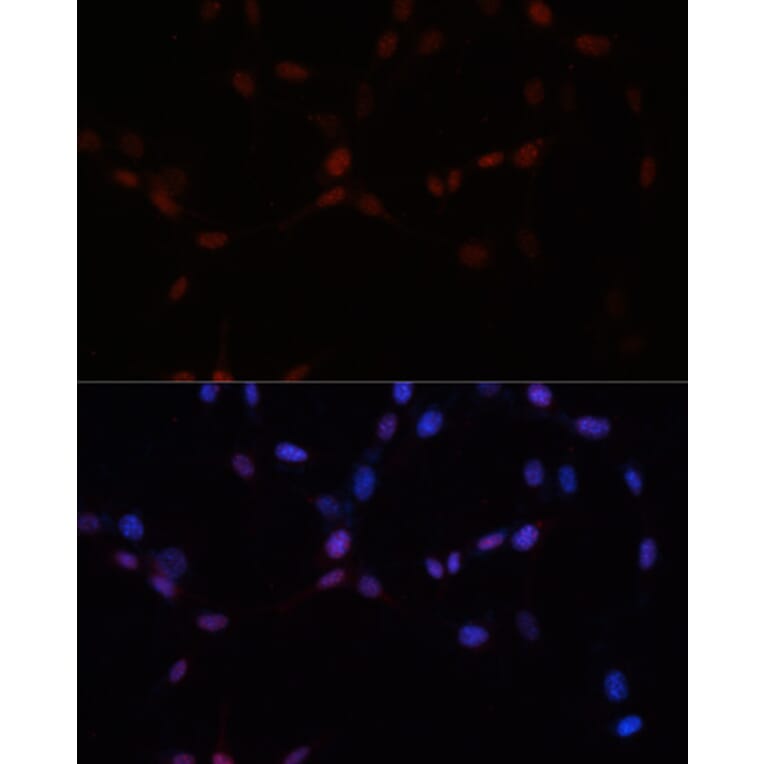 Immunofluorescence - Anti-SUMO1 Antibody (A2130) - Antibodies.com