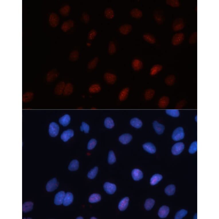 Immunofluorescence - Anti-SUMO1 Antibody (A2130) - Antibodies.com