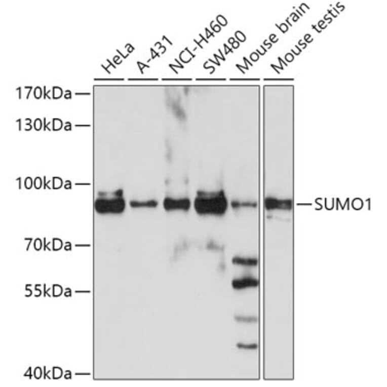 Western Blot - Anti-SUMO1 Antibody (A2130) - Antibodies.com