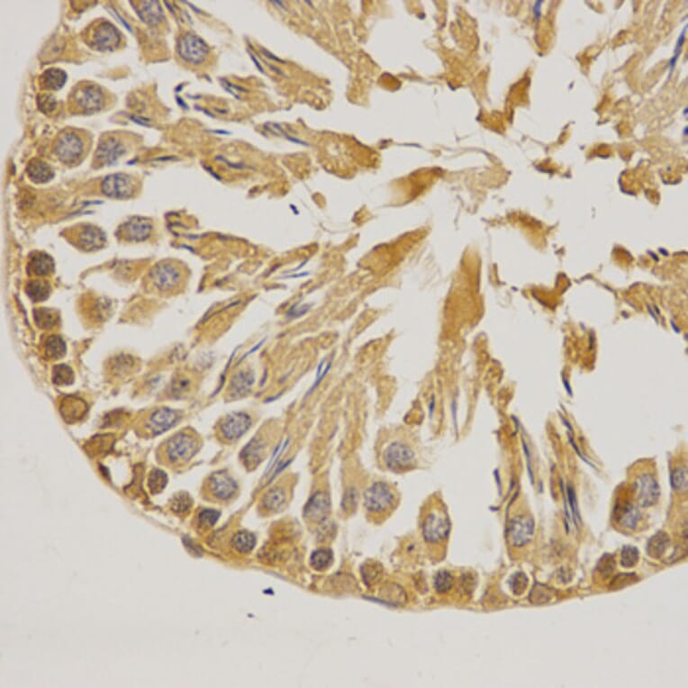 Immunohistochemistry - Anti-SUMO1 Antibody (A2130) - Antibodies.com