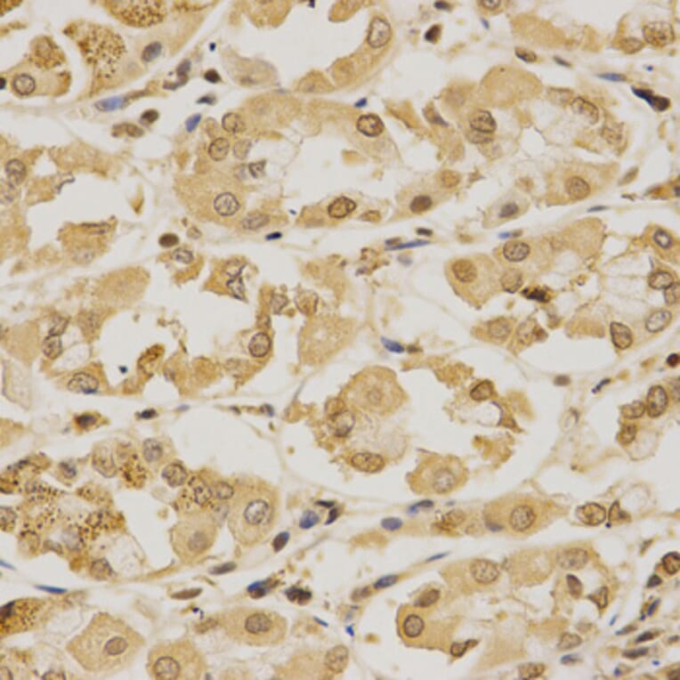 Immunohistochemistry - Anti-SUMO1 Antibody (A2130) - Antibodies.com