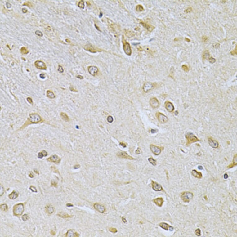 Immunohistochemistry - Anti-SUMO1 Antibody (A2130) - Antibodies.com