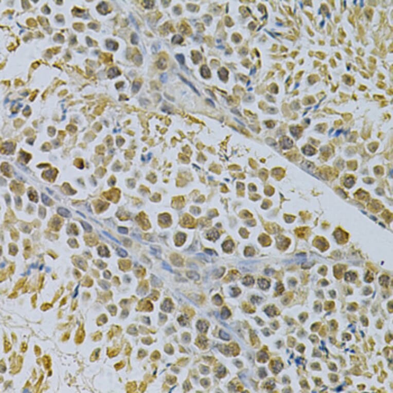 Immunohistochemistry - Anti-SUMO1 Antibody (A2130) - Antibodies.com