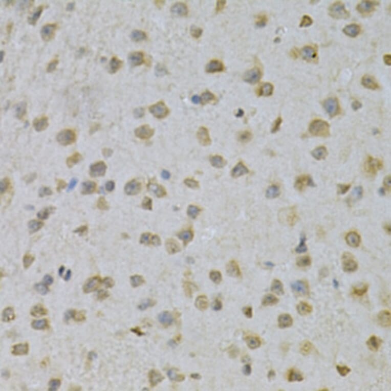 Immunohistochemistry - Anti-SUMO1 Antibody (A2130) - Antibodies.com