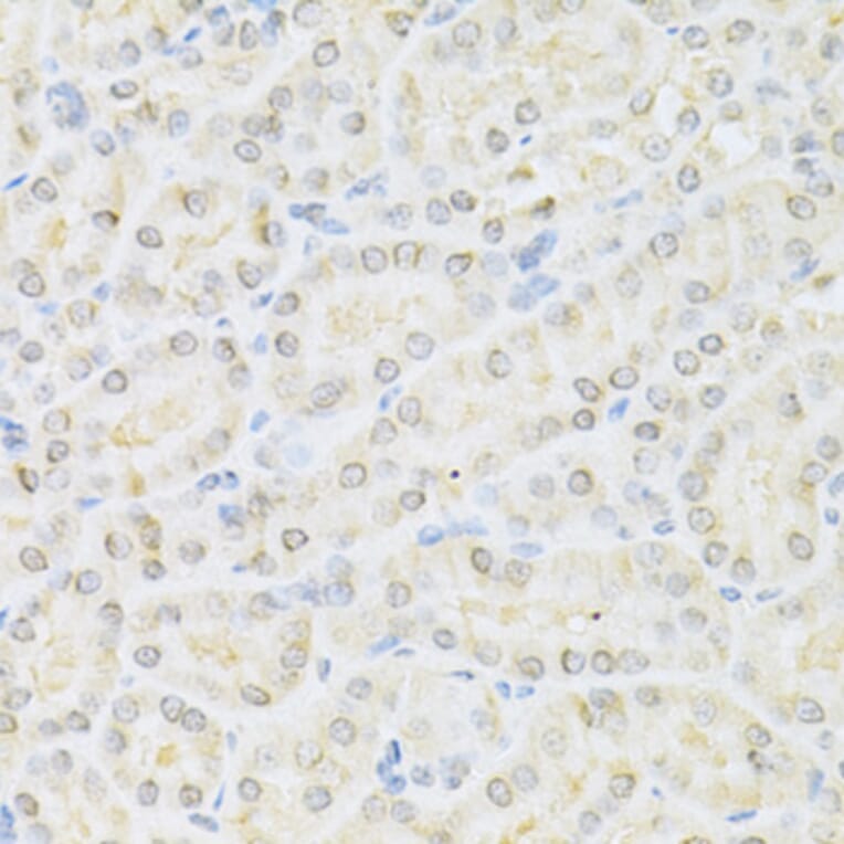 Immunohistochemistry - Anti-SUMO1 Antibody (A2130) - Antibodies.com