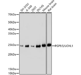 Western Blot - Anti-PGP9.5 Antibody (A13896) - Antibodies.com