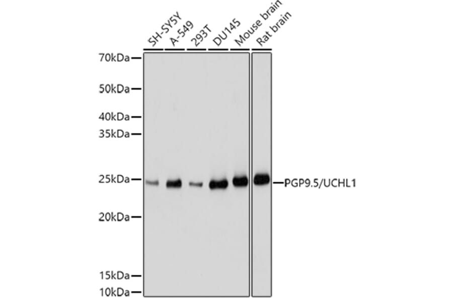 Western Blot - Anti-PGP9.5 Antibody (A13896) - Antibodies.com
