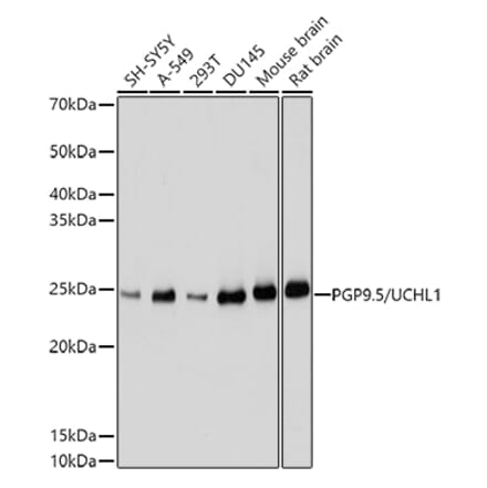 Western Blot - Anti-PGP9.5 Antibody (A13896) - Antibodies.com