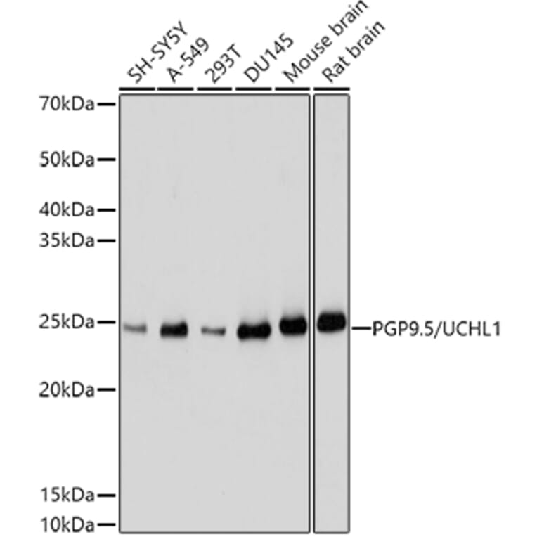 Western Blot - Anti-PGP9.5 Antibody (A13896) - Antibodies.com