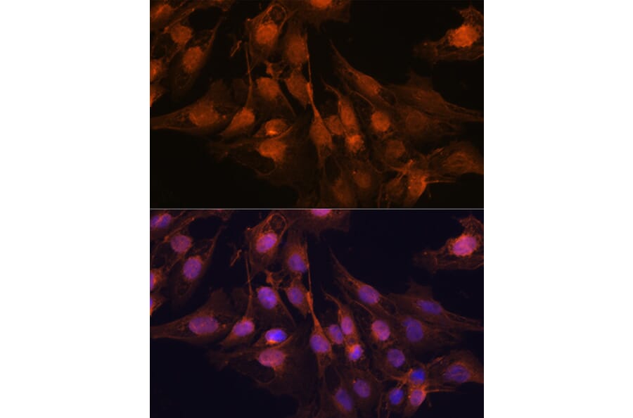 Immunofluorescence - Anti-PGP9.5 Antibody (A13896) - Antibodies.com