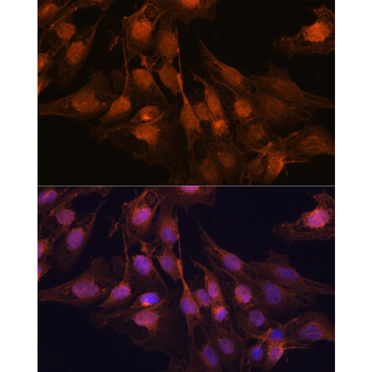 Immunofluorescence - Anti-PGP9.5 Antibody (A13896) - Antibodies.com
