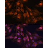 Immunofluorescence - Anti-PGP9.5 Antibody (A13896) - Antibodies.com